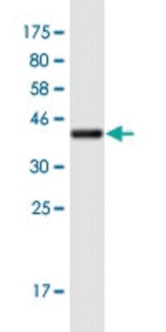 Monoclonal Anti-HKR1 antibody produced in mouse