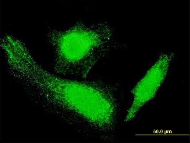 Monoclonal Anti-HD antibody produced in mouse