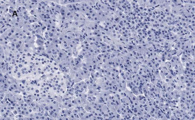 Anti-S6 Ribosomal Protein Antibody, clone 1E9, ZooMAb<sup>®</sup> Rabbit Monoclonal