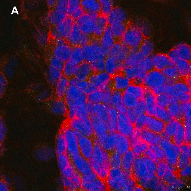 Anti-phospho-TrkB (Tyr816) Antibody, clone 2C21 ZooMAb<sup>®</sup> Rabbit Monoclonal