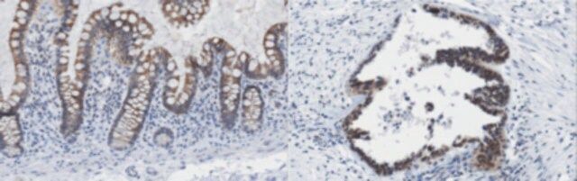 Anti-ING3 Antibody, clone 2A2