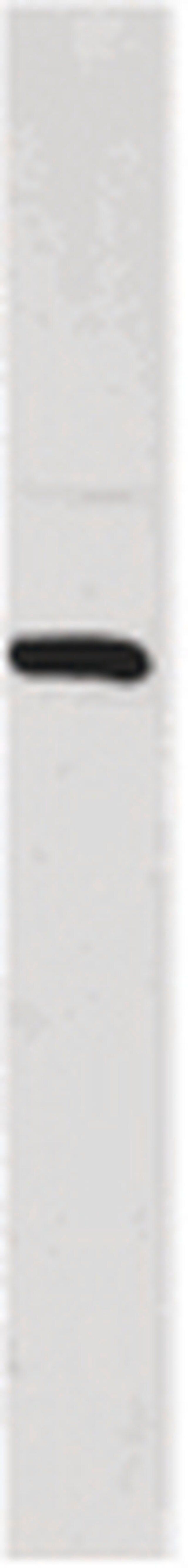 Anti-Huntingtin-Interacting Protein (HIP1) Antibody