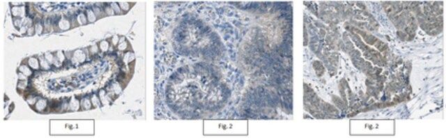 Anti-IDH1/2 Mutant (R132/172) Antibody, clone MsMab-1
