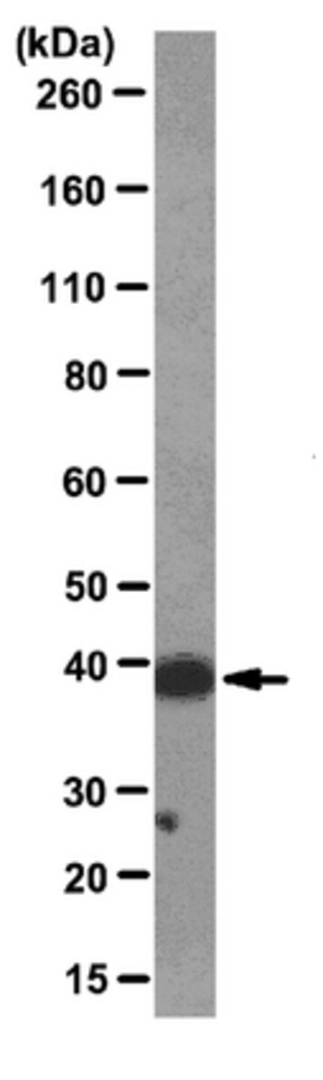 Anti-macro-H2A1.2 Antibody, clone 14G7