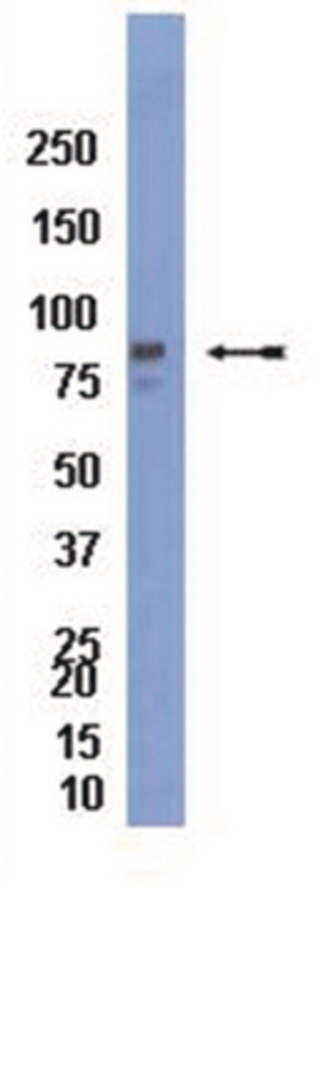 Anti-Mitofilin Antibody