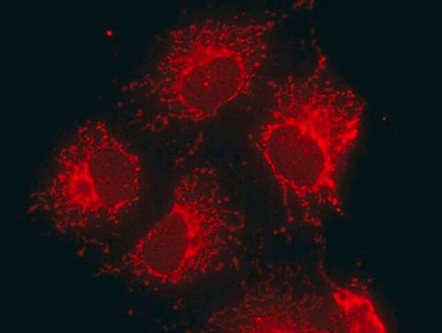 Anti-Mitochondria Antibody