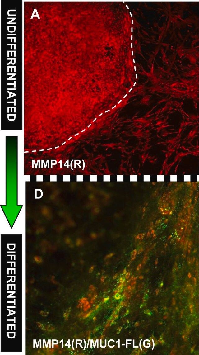 Anti-MMP-14 Antibody