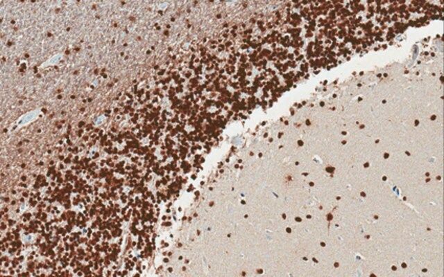 Anti-nAChR α4 Subunit Antibody, clone 369
