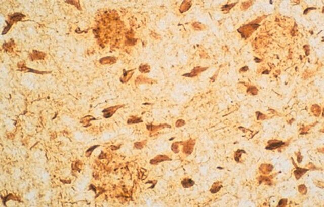 Anti-Neurofibrillary Tangles Antibody