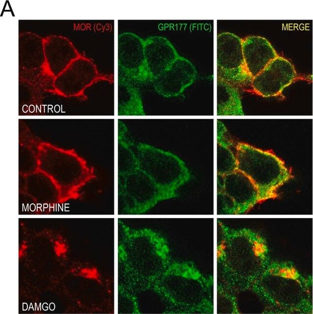Anti-Opioid Receptor Antibody, μ, pain