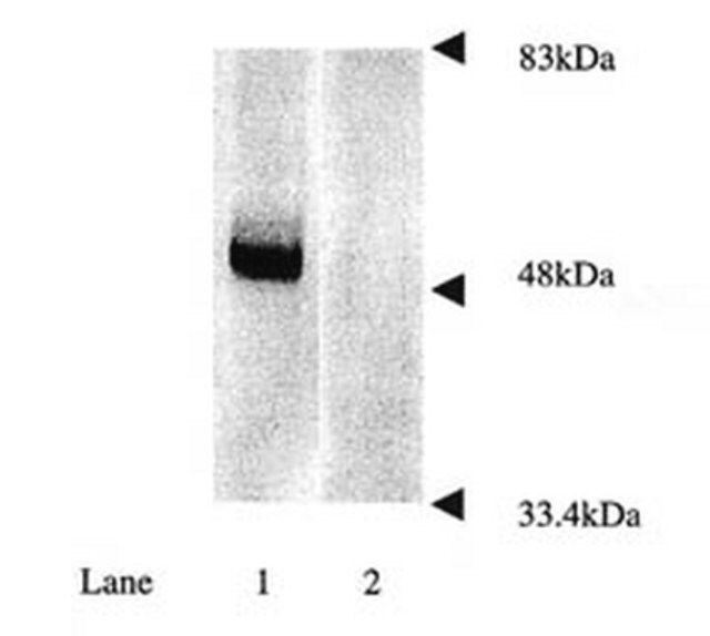 Anti-Parkin Antibody, a.a. 305-323