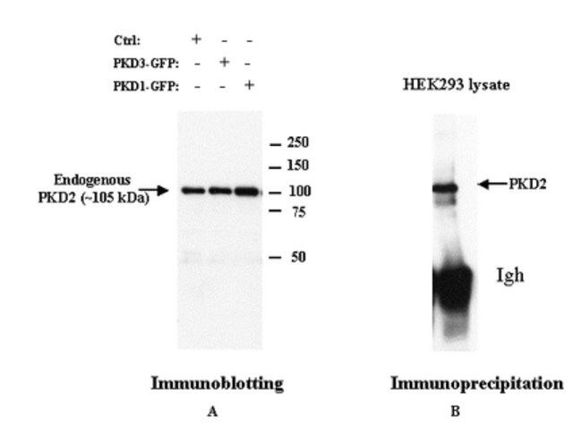 Anti-PKD2 Rabbit pAb