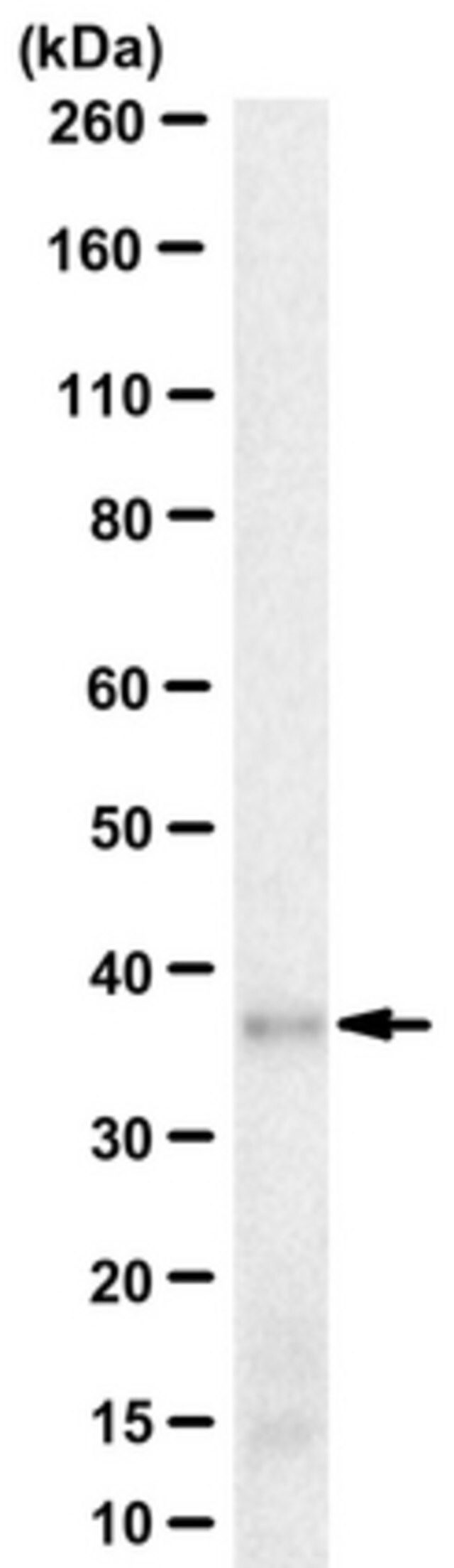 Anti-Peripherin-2 Antibody, clone 5H2