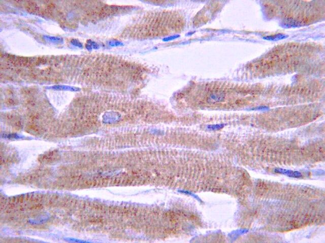 Anti-Potassium Channel KvLQT1 Antibody, CT