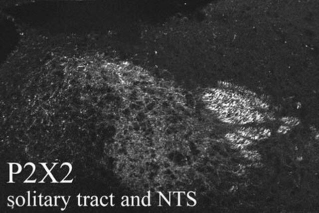 Anti-P2X2 Receptor Antibody