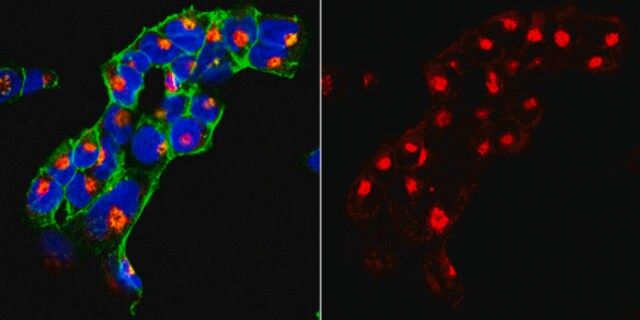 Anti-SorLA Antibody, clone 20C11