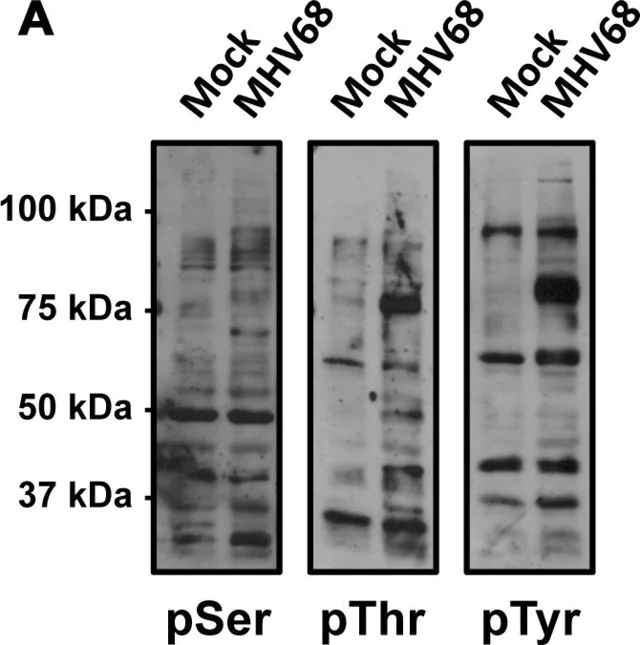 Anti-Phosphoserine Antibody
