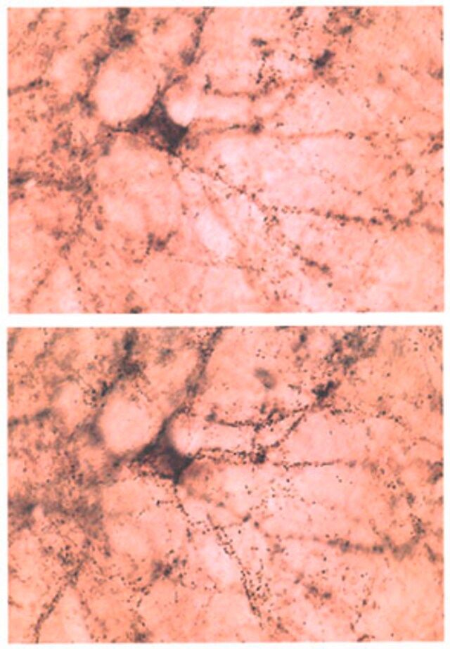 Anti-Synuclein β Antibody