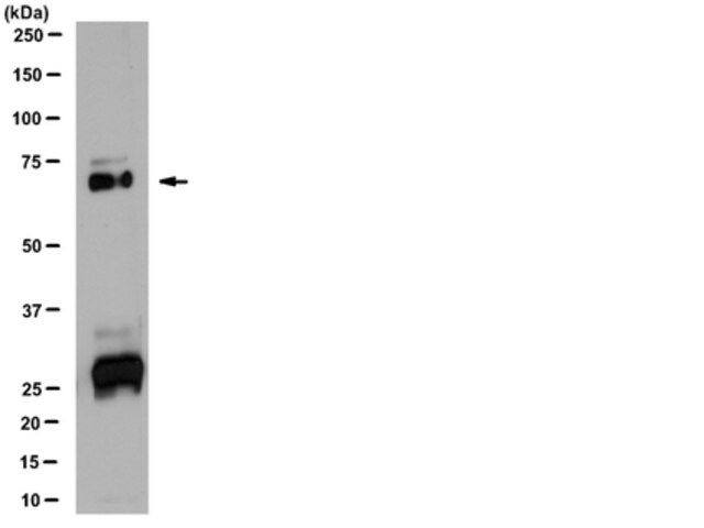 Anti-Vitamin K dependent protein S Antibody