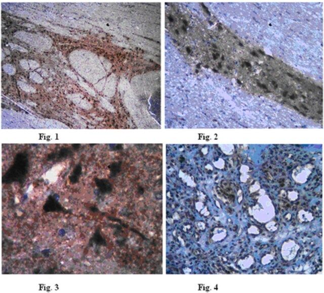 Anti-TIGAR Antibody