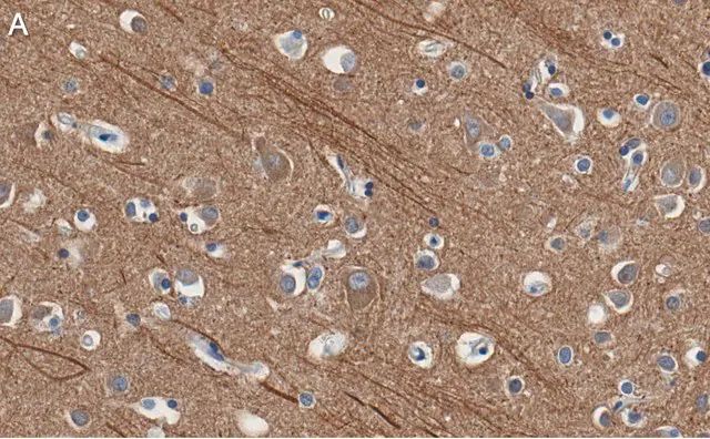 Anti-Presenilin-1 Antibody, clone 2O13 ZooMAb<sup>®</sup> Rabbit Monoclonal