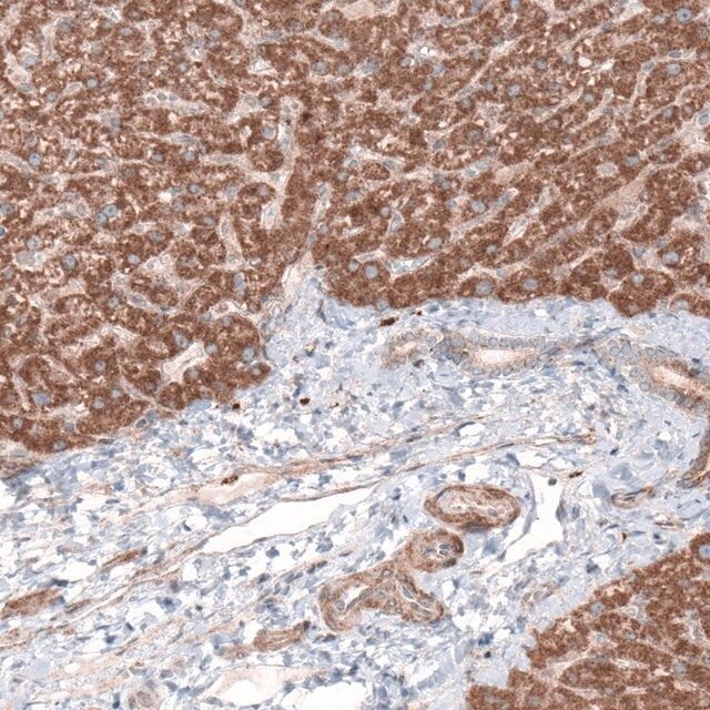 Monoclonal Anti--G6PC antibody produced in mouse
