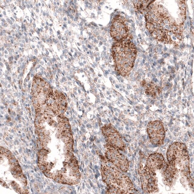 Monoclonal Anti-GRN antibody produced in mouse