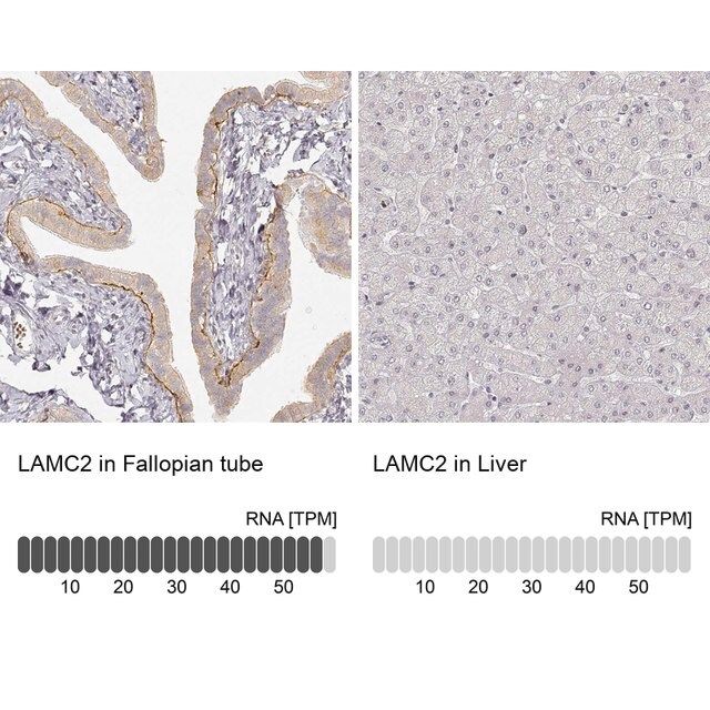 Monoclonal Anti-LAMC2 antibody produced in mouse