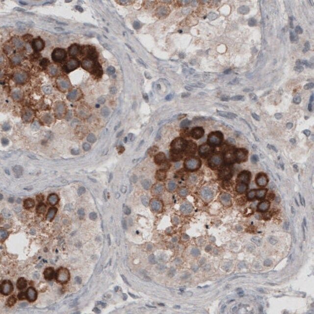 Monoclonal Anti-LY6K antibody produced in mouse