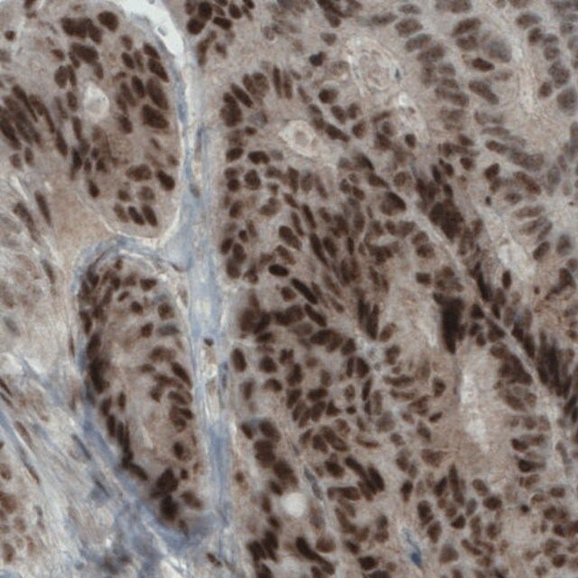 Monoclonal Anti-NSD2 antibody produced in mouse