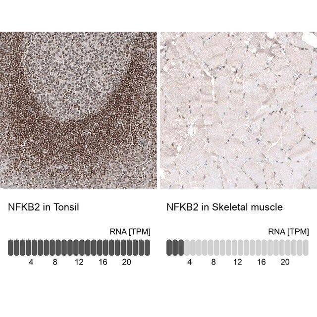 Monoclonal Anti-NFKB2 antibody produced in mouse
