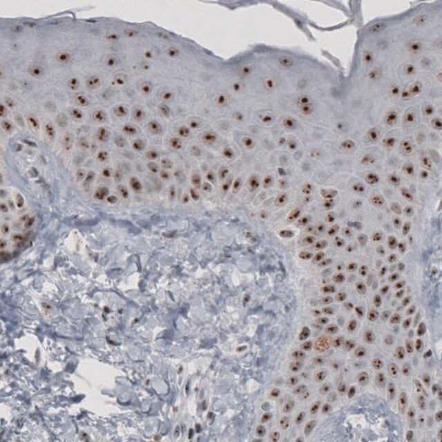 Monoclonal Anti-MKI67IP from mouse