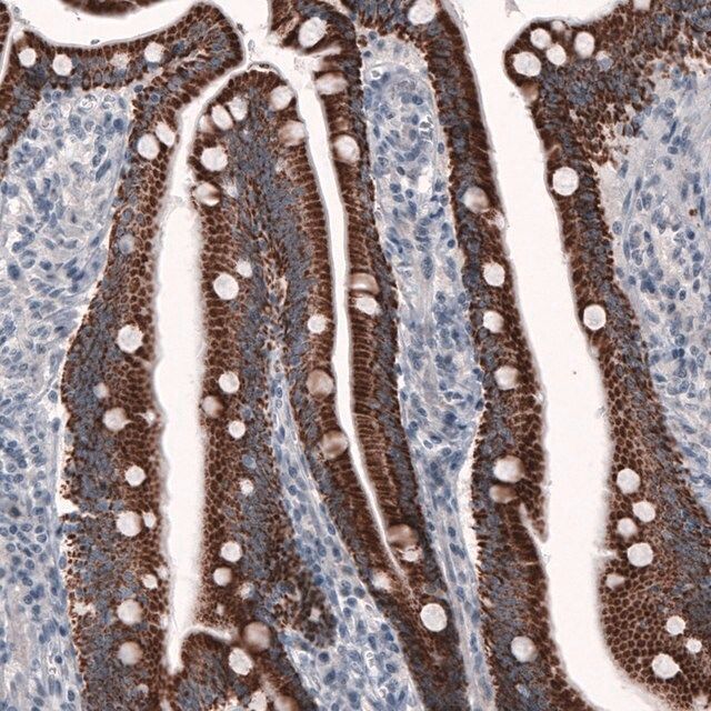 Monoclonal Anti-OTC antibody produced in mouse