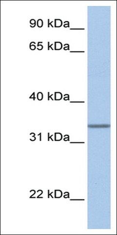Anti-SPDEF (AB1) antibody produced in rabbit