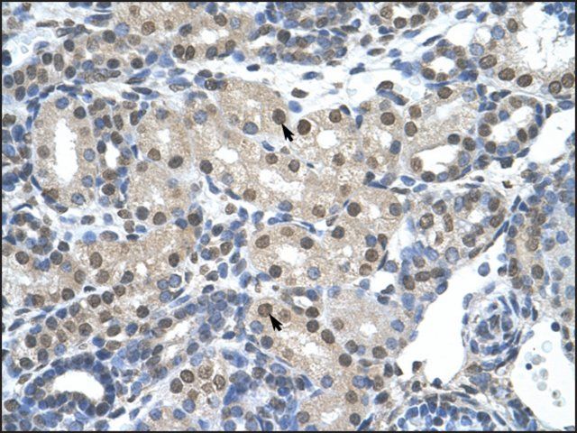 Anti-SNRP70 (AB1) antibody produced in rabbit