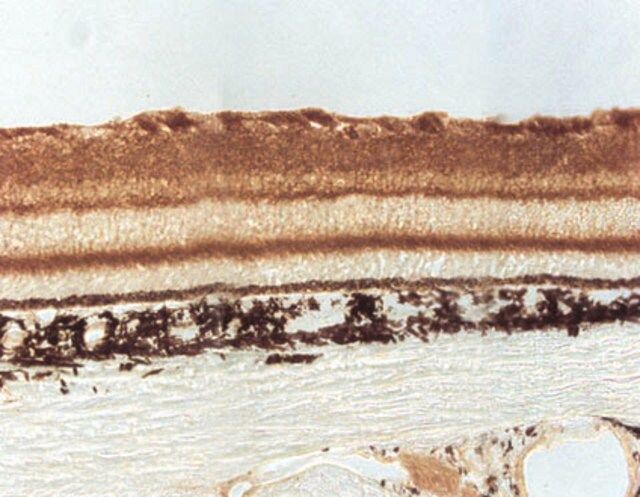 Anti-Sodium Channel NaB2 Antibody