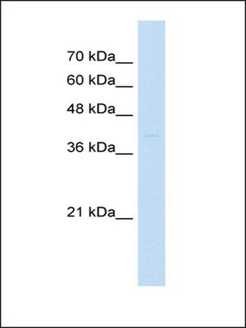 Anti-ST3GAL3 (AB1) antibody produced in rabbit