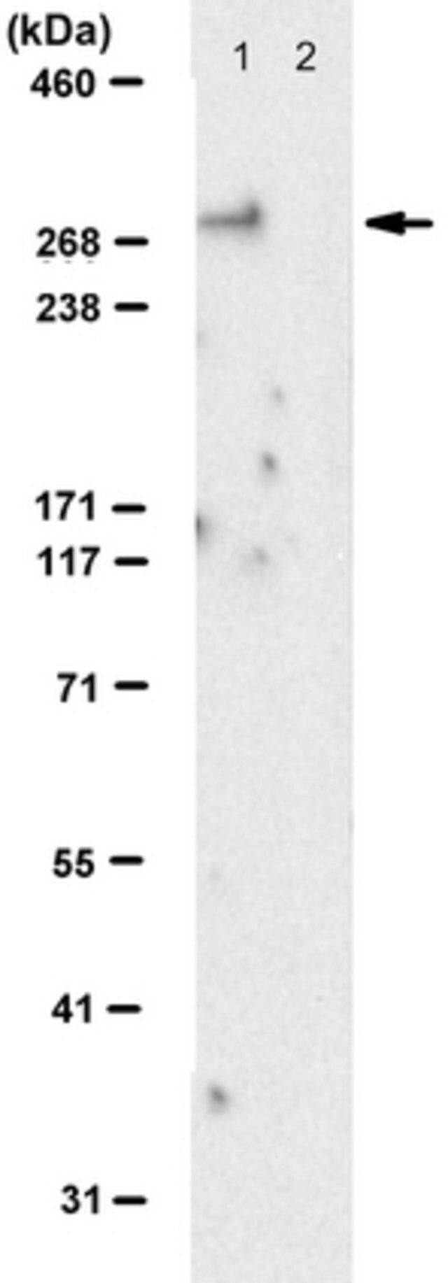 Anti-Spectrin beta-II Antibody, clone 2A7
