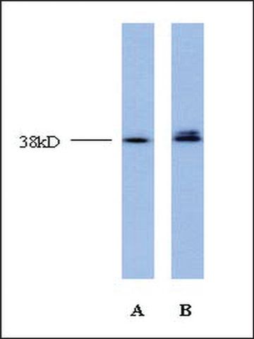 Anti-TCF4 (AB2) antibody produced in rabbit