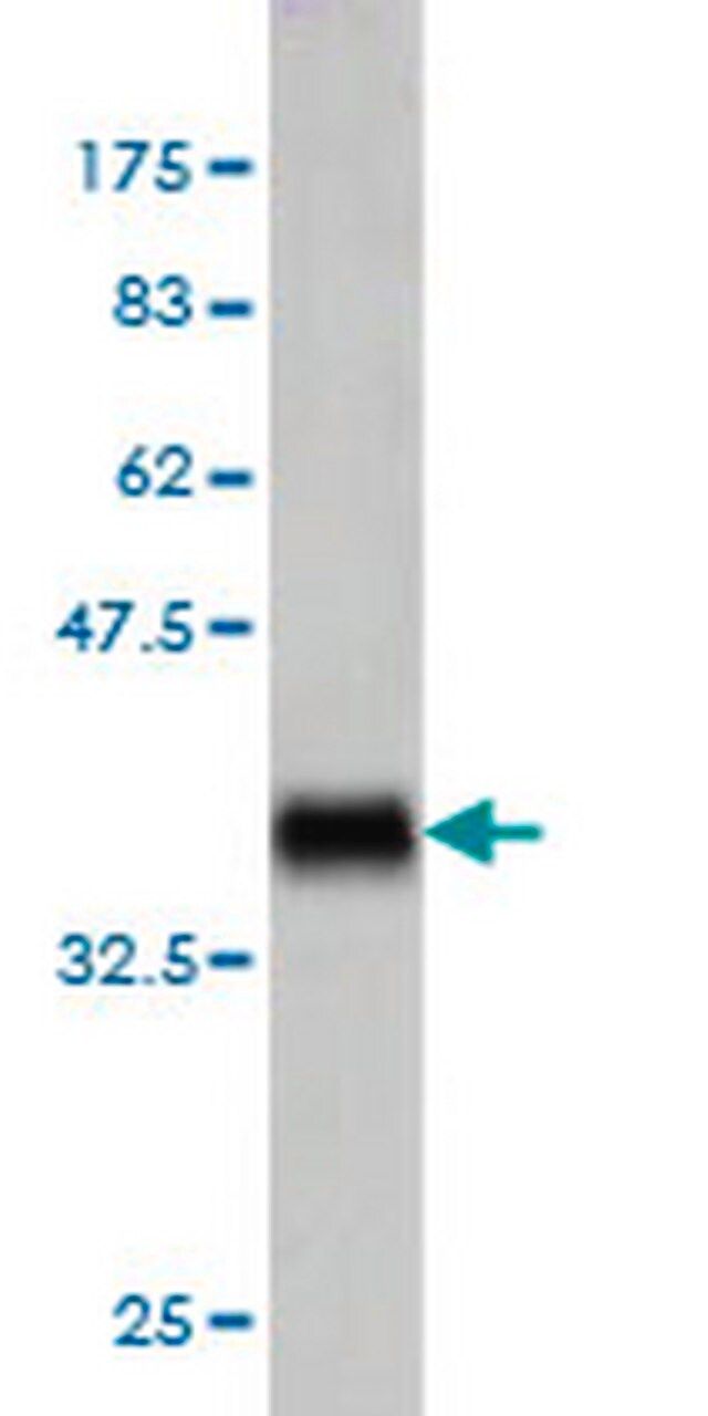 Anti-TNFSF14 Mouse mAb (4E3)