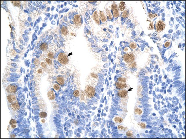 Anti-TEAD3 (AB2) antibody produced in rabbit