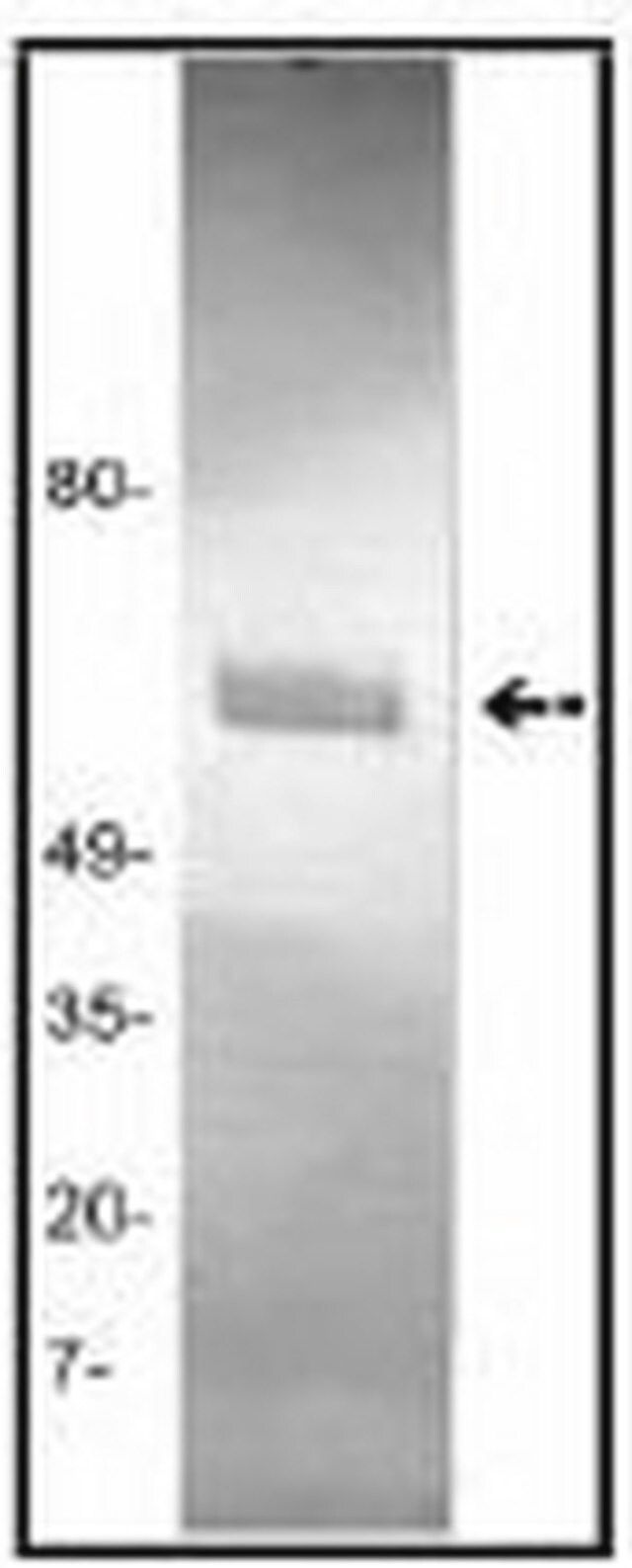 Anti-Tissue Plasminogen Activator (Ab-1) Mouse mAb (GMA-043)