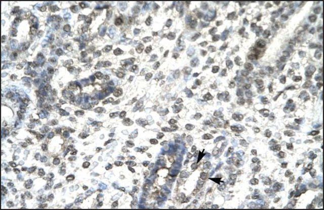 Anti-TBX21 antibody produced in rabbit
