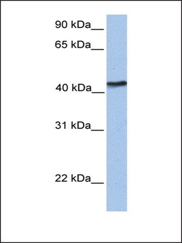 Anti-TMEM149 antibody produced in rabbit