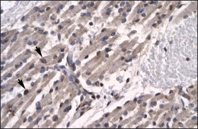 Anti-TFCP2L1 (AB1) antibody produced in rabbit