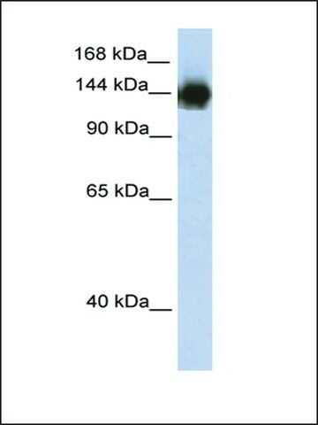Anti-TIMELESS (AB1) antibody produced in rabbit