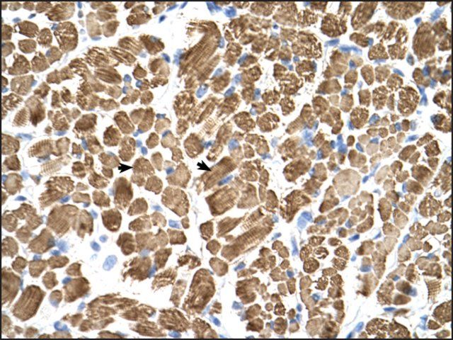 Anti-TPM2 antibody produced in rabbit