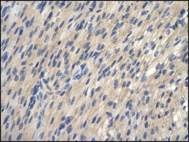Anti-TRIP13 (AB1) antibody produced in rabbit