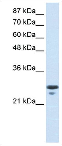 Anti-TFAM (AB1) antibody produced in rabbit