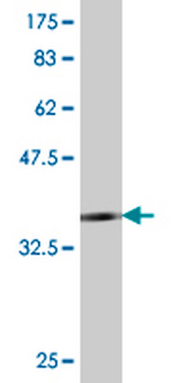 Anti-TLR4 Mouse mAb (1H7)